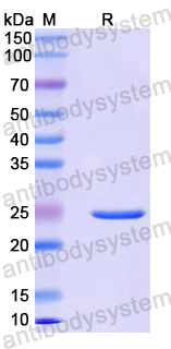 Recombinant Mouse CD140a/PDGFRA Protein, N-His