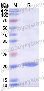Recombinant Mouse ALOX12 Protein, N-His