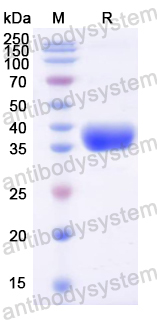 Recombinant Mouse ADCYAP1 Protein, N-GST & C-His