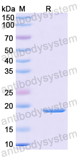 Recombinant Mouse IL1RN/IL-1ra/IL1F3 Protein, N-His