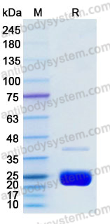 Recombinant Mouse CD120a/TNFR1 Protein, Tag free