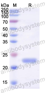 Recombinant Mouse CD11c/ITGAX Protein, N-His