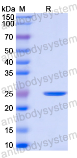 Recombinant Mouse CD333/FGFR3 Protein, N-His