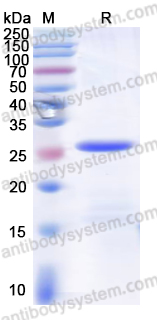 Recombinant Mouse LAMA2 Protein, N-His