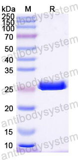 Recombinant Mouse PRTN3 Protein, N-His