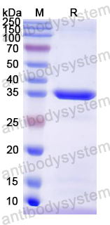 Recombinant Mouse AZGP1 Protein, N-His
