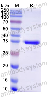Recombinant Mouse MPST Protein, N-His