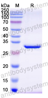 Recombinant Mouse CTSS Protein, N-His