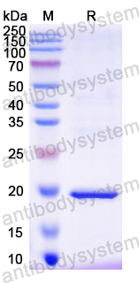 Recombinant Mouse CD314/KLRK1/NKG2D Protein, N-His
