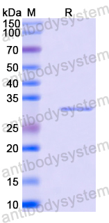 Recombinant Mouse CD26/DPP4 Protein, N-His