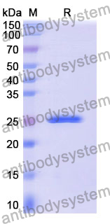 SDS-PAGE for Recombinant Mouse PRSS3 Protein, N-His ?>