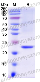 Recombinant Mouse TIMP3 Protein, N-His
