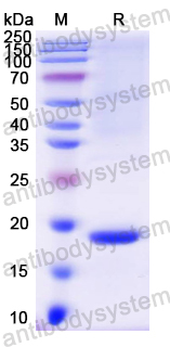 Recombinant Mouse ATP7B Protein, N-His