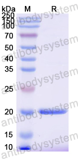 Recombinant Mouse TNFSF9/4-1BBL Protein, N-His