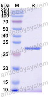 Recombinant Mouse CTSK Protein, N-His