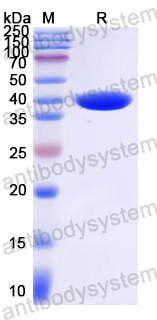 Recombinant Mouse GATA4 Protein, N-GST & C-His