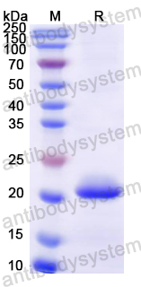 Recombinant Mouse RANBP2 Protein, N-His