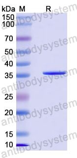 Recombinant Mouse GPC3/Glypican 3 Protein, N-His-SUMO