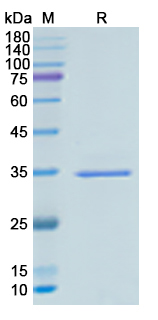  for Recombinant Mouse VCP Protein, N-His ?>