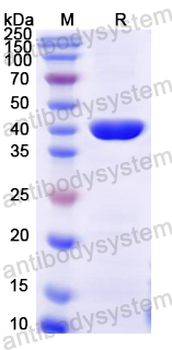 Recombinant Mouse F2RL1/PAR-2 Protein, N-GST & C-His