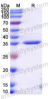 Recombinant Mouse BCAR1 Protein, N-GST & C-His