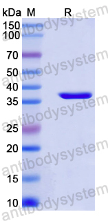 Recombinant Mouse PROK1/EG-VEGF Protein, N-GST & C-His