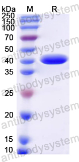 Recombinant Mouse Uba52 Protein, N-GST