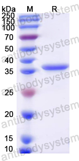 Recombinant Mouse CD172a/SIRPA Protein, N-His