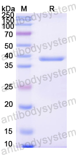 Recombinant Mouse CCL8/MCP-2 Protein, N-GST & C-His