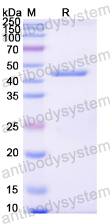 Recombinant Mouse GPLD1 Protein, N-His