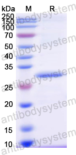 Recombinant Mouse HSD11B2 Protein, N-His