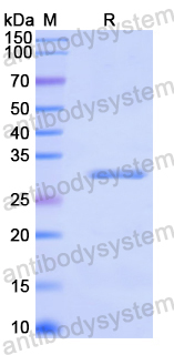 Recombinant Mouse VLDLR Protein, N-His