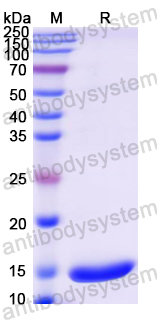Recombinant Mouse TFF2 Protein, N-His