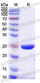 Recombinant Mouse FADD Protein, N-His