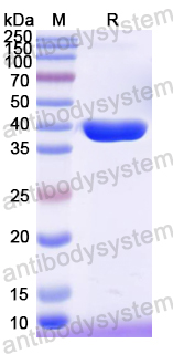 Recombinant Mouse RIPK1 Protein, N-His