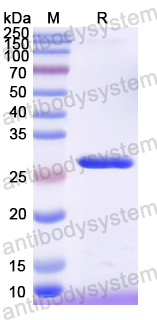 Recombinant Mouse LAMB3 Protein, N-His