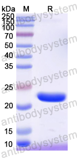 Recombinant Mouse LAMC2 Protein, N-His