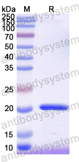 Recombinant Mouse IL18 Protein, N-His