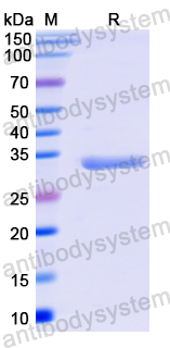 Recombinant Mouse ADGRE1/EMR1 Protein, N-His