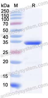 Recombinant Mouse Il11ra1/Etl-2/NR1 Protein, N-His