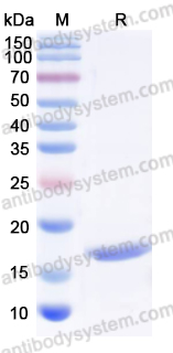 Recombinant Mouse CD279/PDCD1/PD1 Protein, N-His