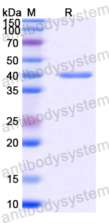 Recombinant Mouse TGFBI Protein, N-His