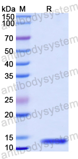 Recombinant Mouse TIGIT Protein, N-His