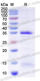Recombinant Mouse IL23R Protein, N-His