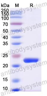 Recombinant Mouse ANGPTL8 Protein, N-His