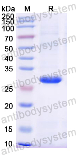 Recombinant Mouse STING1/TMEM173 Protein, N-His
