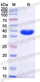 Recombinant Mouse TRPV1 Protein, N-His