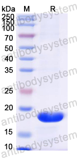 Recombinant Mouse CIDEC Protein, N-His