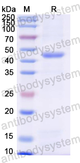 Recombinant Mouse LOXL4 Protein, N-His