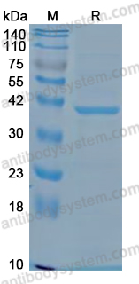 Recombinant Mouse NLRP3 Protein, N-His